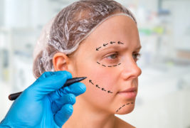 Plastic surgery doctor draw lines with marker on patient face
