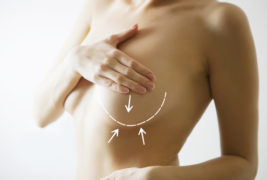 breast cancer and operation concept- body with marks